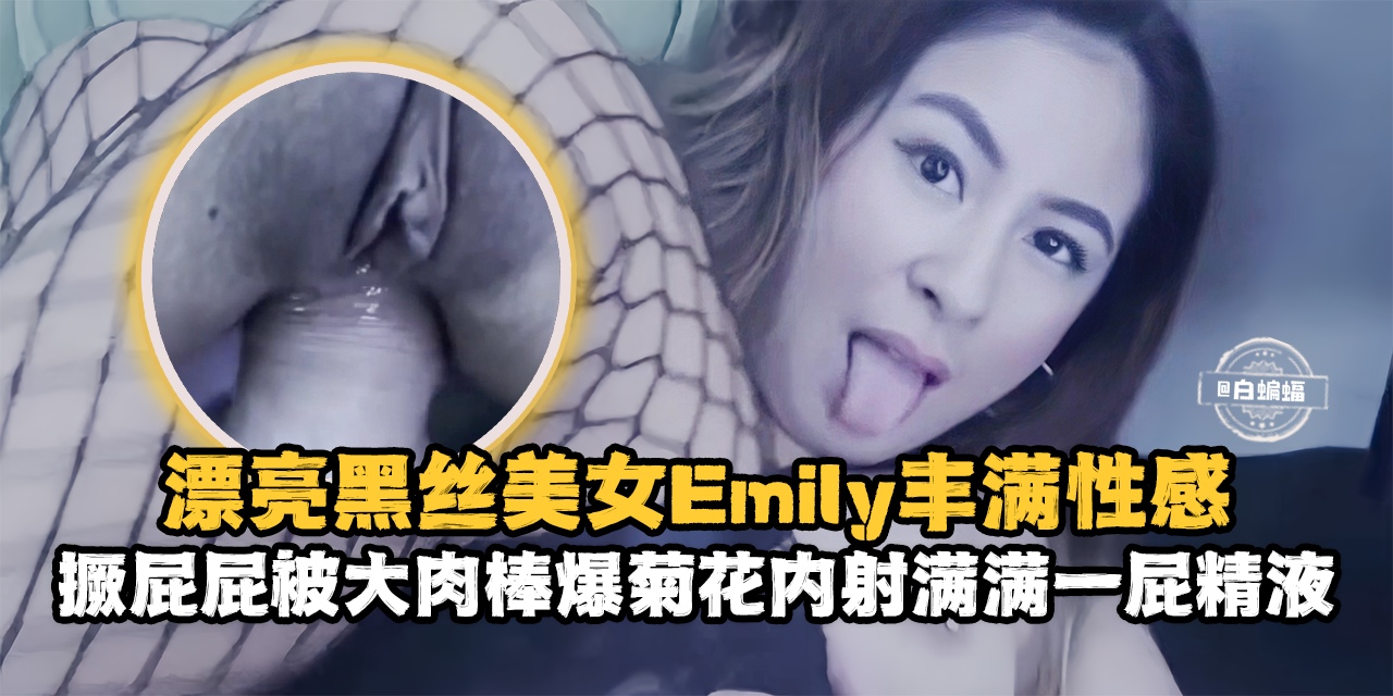 漂亮黑丝美女丰满性感，撅着大屁股被大肉棒爆菊花内射满满一屁股精液-